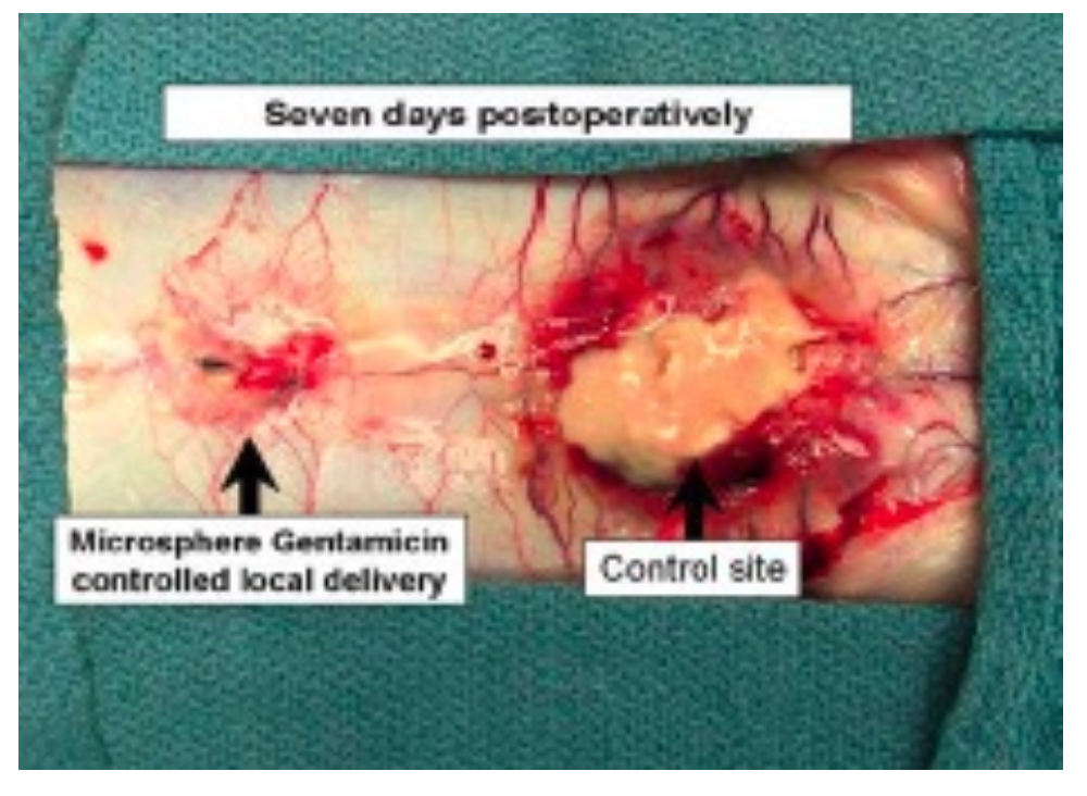 Figure 2: Representative post-mortem rabbit spine image after intra-operative S. aureus challenge